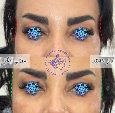 مطب زیبایی آیگل در اصفهان