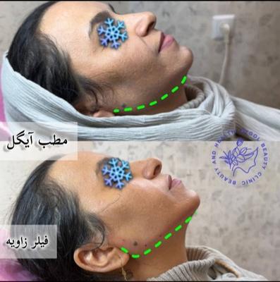 مطب زیبایی آیگل در اصفهان