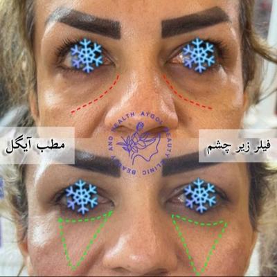 مطب زیبایی آیگل در اصفهان