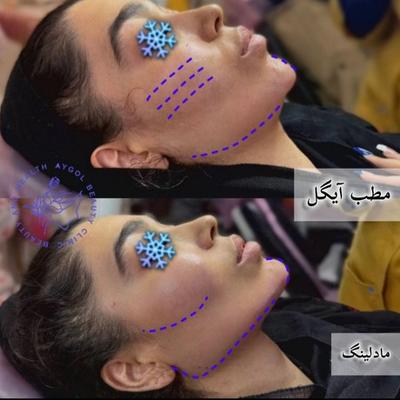 مطب زیبایی آیگل در اصفهان