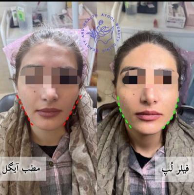 مطب زیبایی آیگل در اصفهان