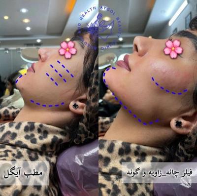 مطب زیبایی آیگل در اصفهان
