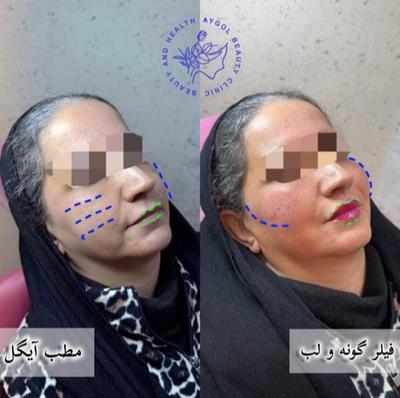 مطب زیبایی آیگل در اصفهان