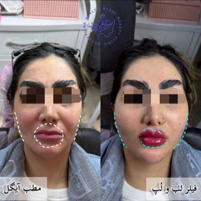 مطب زیبایی آیگل در اصفهان