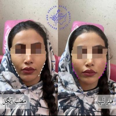 مطب زیبایی آیگل در اصفهان