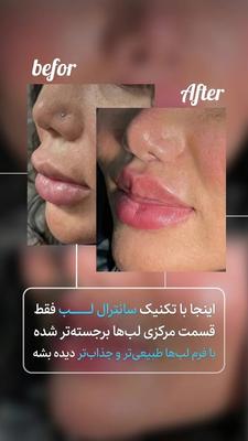 سانترال لب در تهران