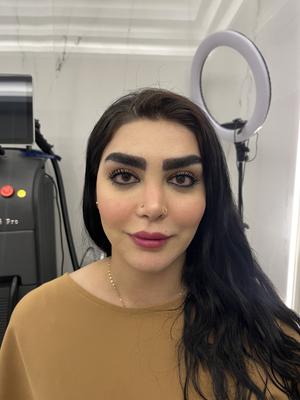 فیلر صورت آلمانی secro-fill فقط 3/500 در تهران