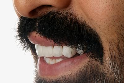 دندانپزشکی اقساط در کرج 
کامپوزیت ونییر 
لمینت 
ایمپلنت 
عصب کشی در کرج
