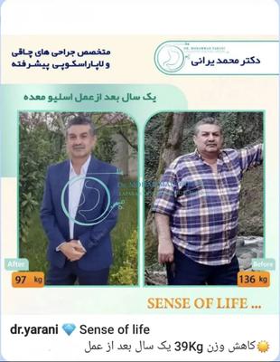 لاغری اسلیو معده با دکتر یرانی جراح با تجربه در تهران