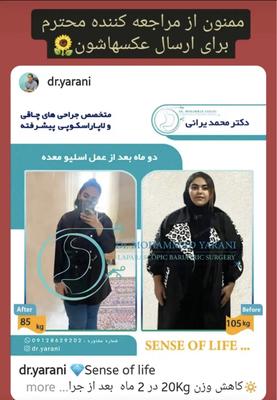 لاغری اسلیو معده با دکتر یرانی جراح با تجربه در تهران