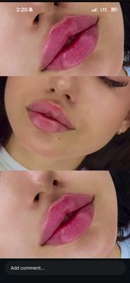 كاشت مو كاشت ابرو در تبریز