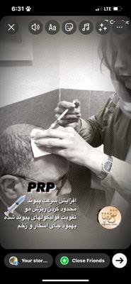 مزوتراپی.پی آر پی.هیرفیلر در اهواز