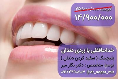 خداحافظی با زردی دندان در تهران
