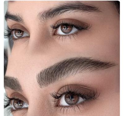 میکروبلیدینگ فیبروز ابرو در اصفهان