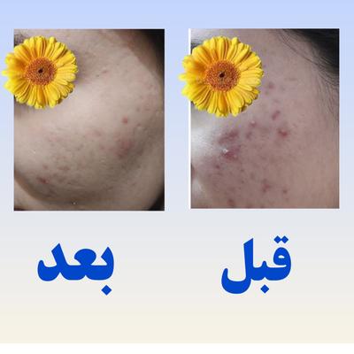 پوست و مو در آمل