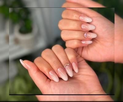 آمبره کاشت ژل در بندر کنگان