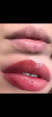 میکرو پیگمنتیشن و میکرو بلیدینگ در قزوین