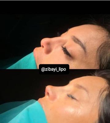 جراحی زیبایی  اقساطی در اسلامشهر