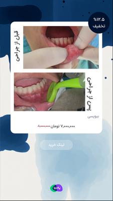 بیوپسی در تهران