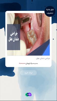 جراحی دندان عقل در تهران