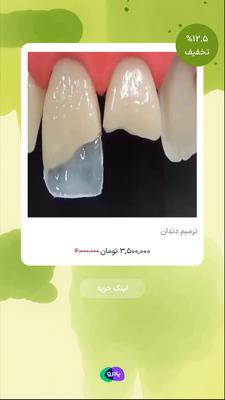 ترمیم در تهران