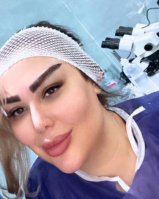 کاشت ابرو متد فاین برو در شیراز