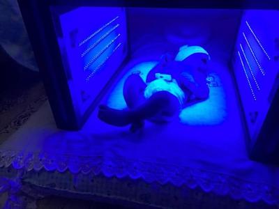 کرایه دستگاه زردی نوزاد/فتوتراپی(کل مناطق) در تهران