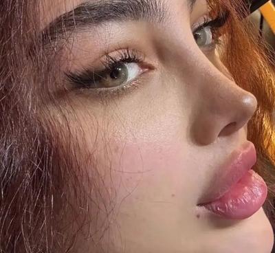 عمل جراحی بینی‌ فقط ۴۵ در قدس