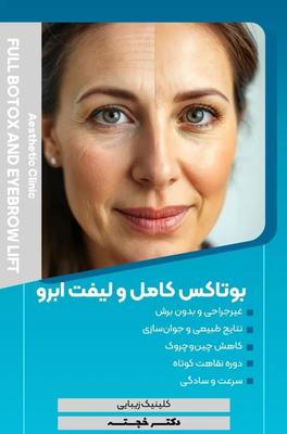 جشنواره بوتاکس مصپورت با قیمت فوق العاده در چناران
