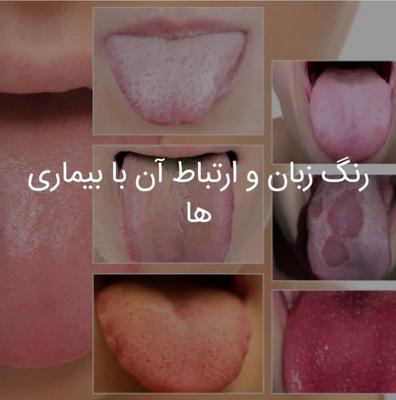 کار آفرینی بانوان در تاکستان
