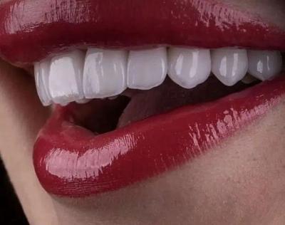 آفر ویژه عیدانه کامپوزیت جشنواره سال نو در اسلامشهر