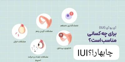 مشاوره درمان ناباروری IUI در چابهار