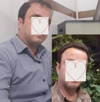 کاشت مو ابرو ریش توسط متخصص پوست و مو در شیراز
