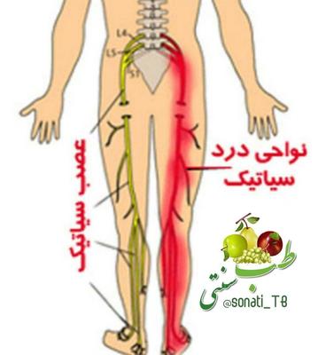 حجامت و زالودرمانی در دورود