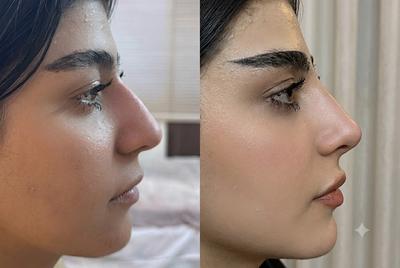 💎 جوانسازی و زیبایی حرفه‌ای در مرکز تخصصی السا در اصفهان