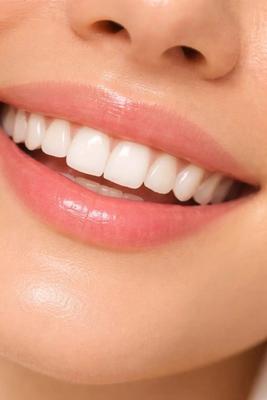 با اعتماد به نفس بخند ارتودنسی دندانپزشکی اقساط در مشهد