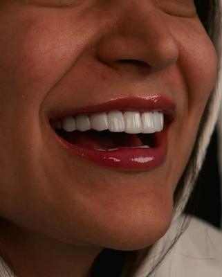 دندانپزشکی قسطی با سفته در مشهد