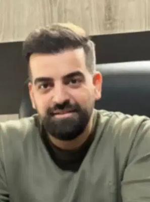 کاشت مو و ابرو میکرو کاشت (رایگان) در تهران