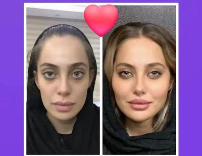 آفر ویژه خدمات زیبایی بوتاکس فیلرو.. کلینیک پزشکی در کرج