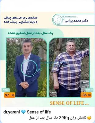 لاغری اسلیو معده_بایپس با ⚜️ دکتر محمد یرانی ⚜️ جراح با تجربه در تهران