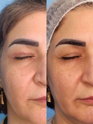 جشنواره عمل های زیبایی به صورت اقساط در اصفهان