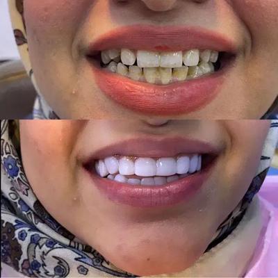 دندانپزشکی اهواز با تعرفه بیمه + ویزیت رایگان در اهواز