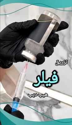 فیلر بادی تخصصی توسط پزشک متخصص تخفیف ویژه در تهران