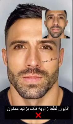 خدمات ویژه آقایانلیزر ،فشیال ،ماساژ توسط کادر آقا در کرج