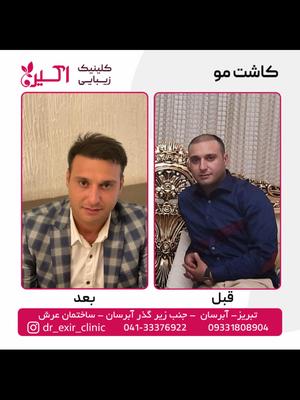 كلينيك تخصصي كاشت مو اكسير . در تبریز