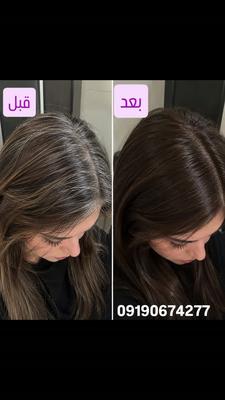 🤎 قبل از بابل موس | بعد از بابل موس ✨ در تهران