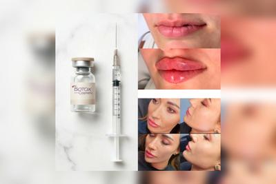 ژل و بوتاکس تزریق حرفه ای وتخصصی(خانمها و اقایان) در اصفهان